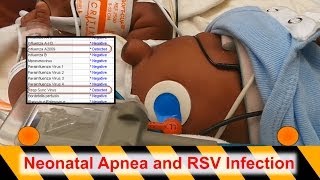 Retinopathy of Prematurity ROP [upl. by Martica]