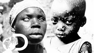 The Eradication Of Smallpox  Invisible Killers [upl. by Arteid821]