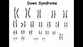 8 Karyotype [upl. by Sikata]