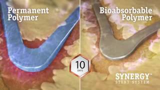 SYNERGY™ Everolimus Eluting Platinum Chromium Coronary Stent System [upl. by Nagard]