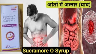 Sucramore O Syrup Benefits uses in Hindi  sucralfate syrup Oxetacaine syrup  Medical Gyan [upl. by Ymma]