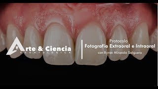 ►Fotografía Extraoral e Intraoral  Dr Byron Miranda Salguero [upl. by Neelhtac427]