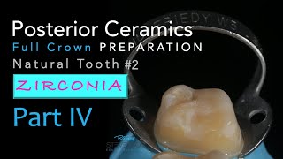 Zirconia Ceramics Part 4 AllCeramic Crown Preparation 2 Natural Tooth [upl. by Ycak]