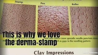 Dermapen Dermaroller DermaStamp HELP HELP [upl. by Helali]