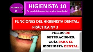 PULIDO DE OBTURACIONES GUÍA PARA EL HIGIENISTA DENTAL [upl. by Deibel]