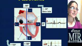 Cómo interpretar un ECG repaso [upl. by Koorb493]