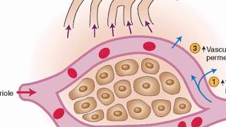 Physiology of Vomiting  Vomiting reflex NEW [upl. by Agler]