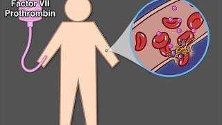 Treating Hemophilia A [upl. by Carrol]