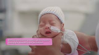 5 Neonatal Respiratory Disorders that Respiratory Therapists and Nurses Should Know [upl. by Nylesaj892]