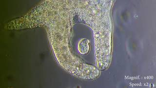 Amoeba eats paramecia  Amoebas lunch   Amoeba Endocytosis  Phagocytosis Part 1  👌 [upl. by Ecnarrat]