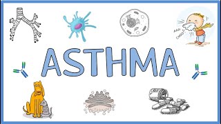 Early Warning Signs of an Asthma Attack [upl. by Eidna]