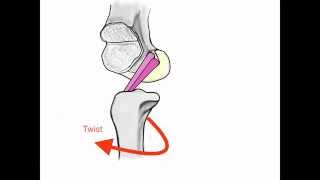 ACL Anatomy [upl. by Gney186]