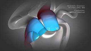 Total Shoulder Replacement Exercises  University Hospital [upl. by Maryjane49]