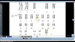 Karyotype analysis [upl. by Areid795]