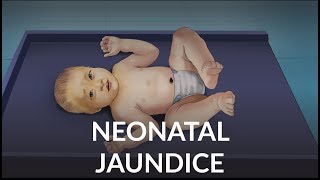 Neonatal Jaundice by L Veit  OPENPediatrics [upl. by Ariamat]