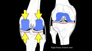 Major Ligaments of the Cervical Spine [upl. by Yddet24]