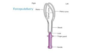 Forceps delivery indications Contraindication and re quest [upl. by Friede]