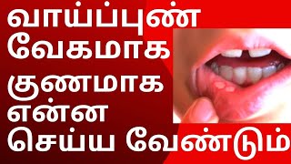 வாய் புண் வேகமாக குணமாக  vaai pun treatment in tamil  Mouth Ulcer Treatment [upl. by Ammeg]