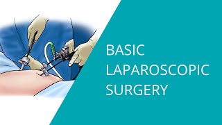 BASIC SETUP EXPLORATORY LAPAROTOMY [upl. by Divadnahtanoj450]