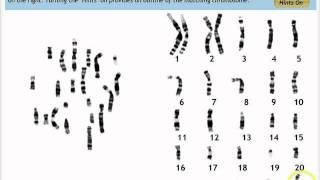 Make a Karyotype [upl. by Zetrom]