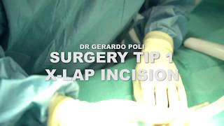 BASIC SET UP EX LAPAROTOMY [upl. by Lundell]