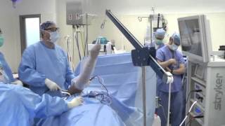 Shoulder Arthroscopy  Acromioplasty [upl. by Remus]