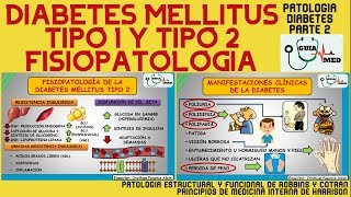 Retinopatía Diabética  Tipos y Tratamiento  Patología Ocular [upl. by Aidole]