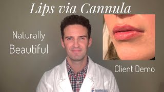 Lips DemoTutorial Cannula amp BD syringe [upl. by Vola]