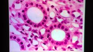 Simple Cuboidal Epithelium [upl. by Eilarol]