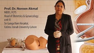 Prof Dr Noreen Akmal  Forceps Delivery Part 1 [upl. by Fredia]