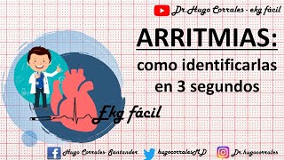 ARRITMIAS CARDÍACAS  como identificarlas en 3 segundos [upl. by Sandi30]