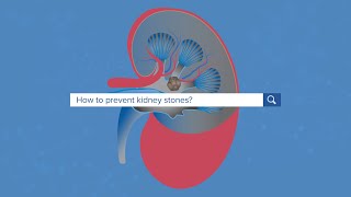 How To Prevent Kidney Stones  Yale Medicine Explains [upl. by Nosemaj]